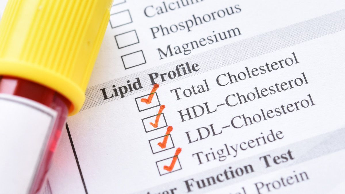 Inilah 4 Cara Mengatasi Kolesterol dan Trigliserida